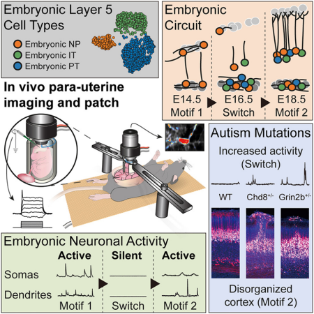 最新研究：胚胎瞬態(tài)多層回路可能引發(fā)自閉癥